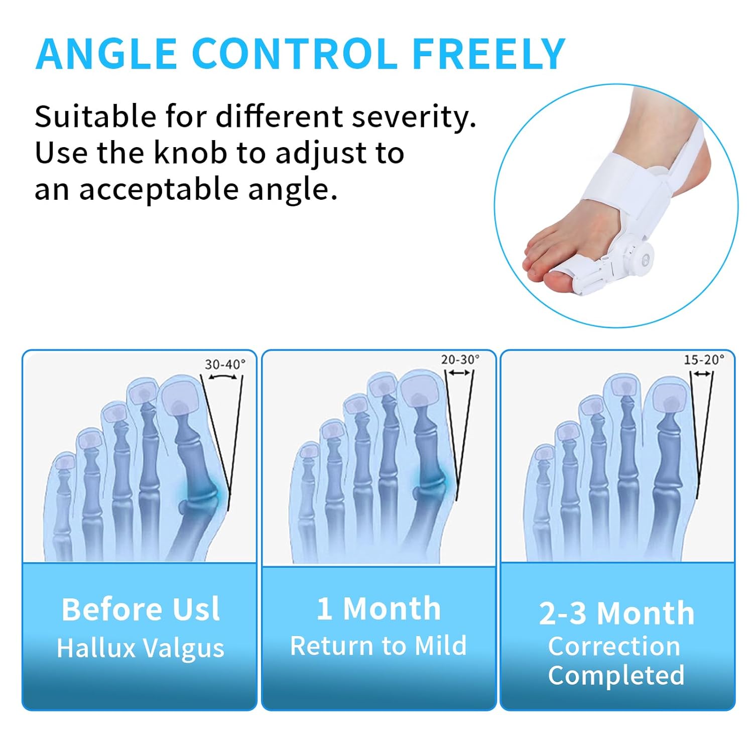 ShopToVista™️  Adjustable Orthopedic Toe Corrector (Works On Both Feet)